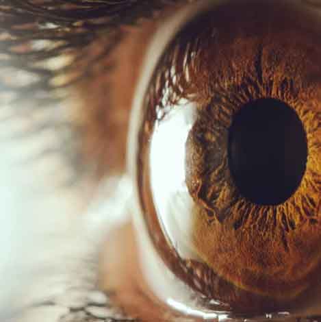 olho castanho para ilustrar artigo sobre oclusões venosas de retina