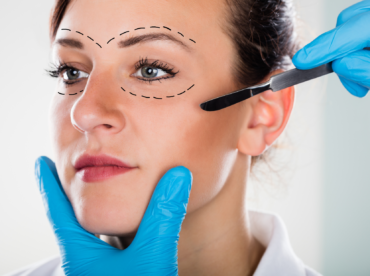 Sobre fundo branco, está em close o rosto de uma mulher branca de olhos verdes, olhando para ângulo fora da foto, com riscos cirúrgicos traçados acima da sobrancelha e nas pálpebras inferiores; segurando seu queixo está uma mão usando luvas azuis e, a outra segura um bisturi perto da maçã do rosto; exemplifica as cirurgias estéticas para a região ocular.