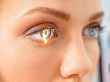 olho de mulher em exame ilustra artigo sobre anel intraestromal